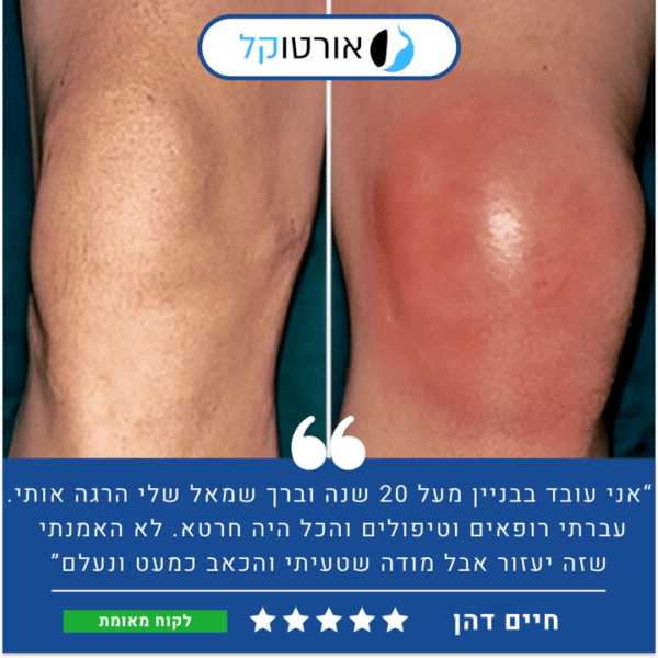 אורטוקל ני פיקס פרימיום - מכשיר מסאג' מקצועי להקלה ארוכת טווח בכאבי ברכיים ב15 דקות שימוש ביום